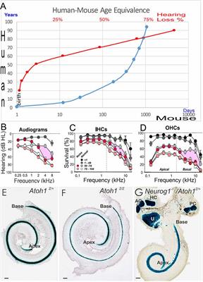 Age-Related Hearing Loss: Sensory and Neural Etiology and Their Interdependence